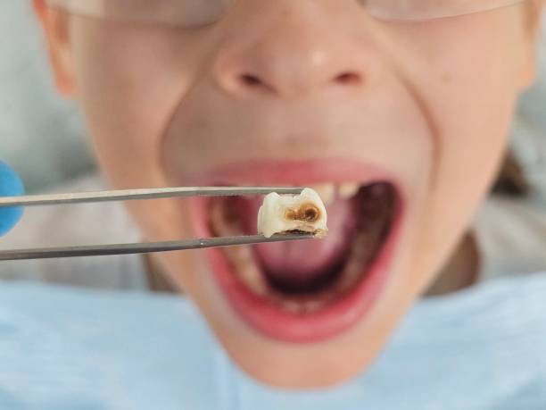 Best Broken or Cracked Tooth Emergency Dentist in Brackenridge, PA